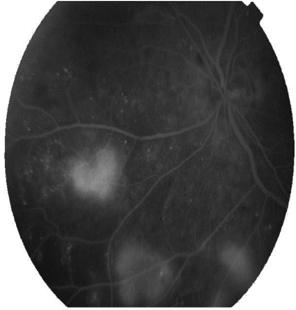 Eye fundus image registration method, eye fundus image optic disk nerve and vessel measuring method and eye fundus image matching method