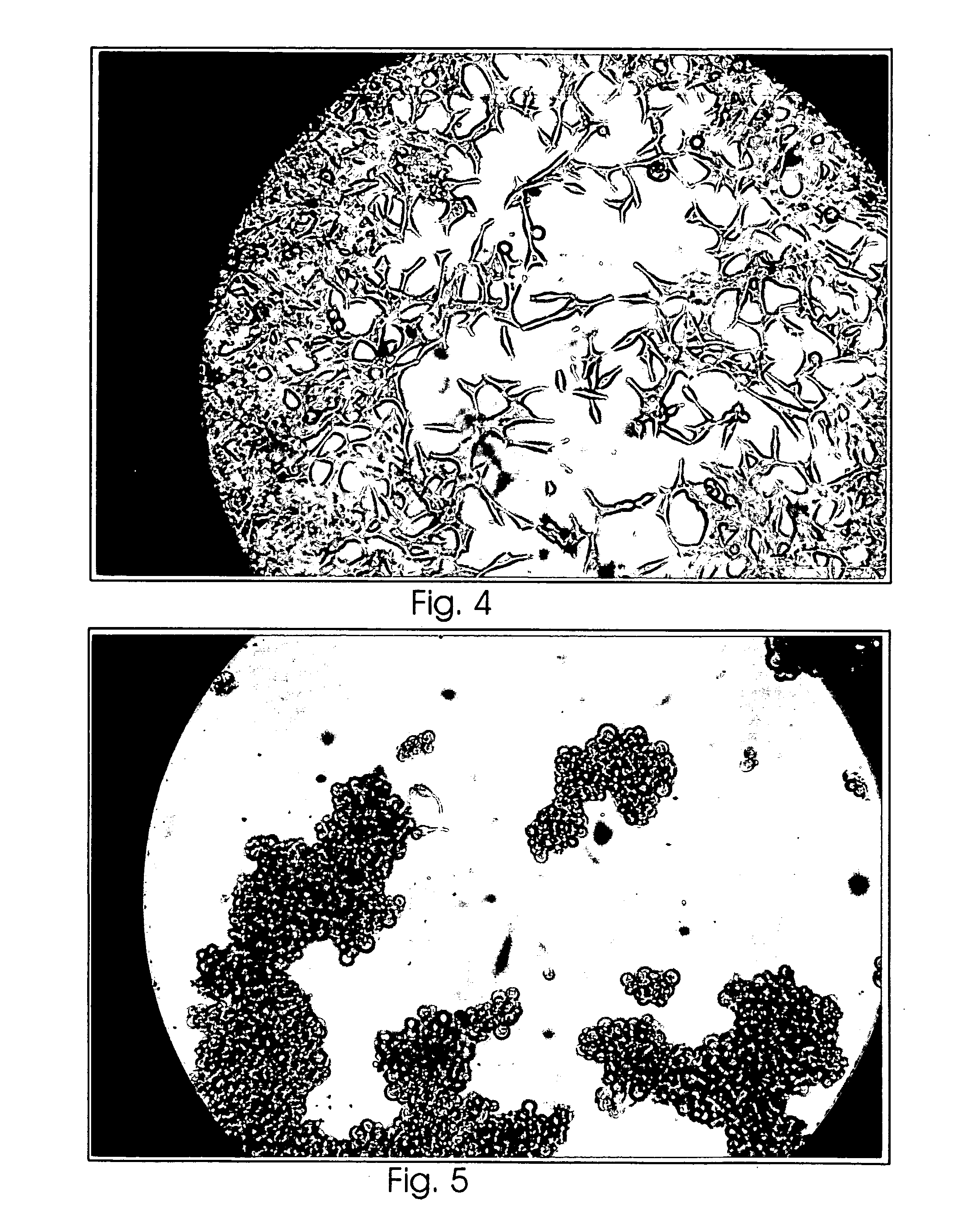 Polypeptide for the treatment of cancer and a method for preparation thereof