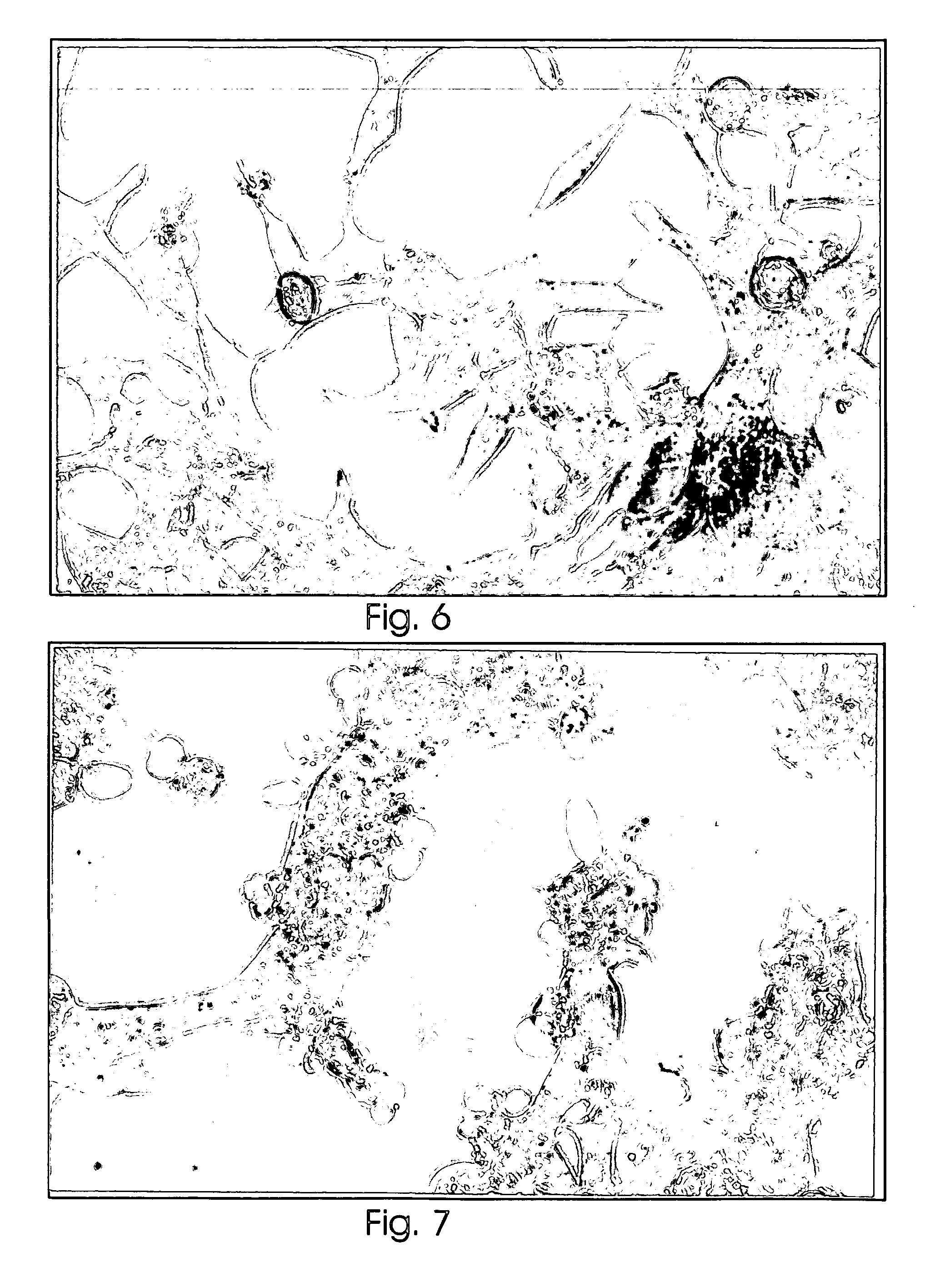 Polypeptide for the treatment of cancer and a method for preparation thereof