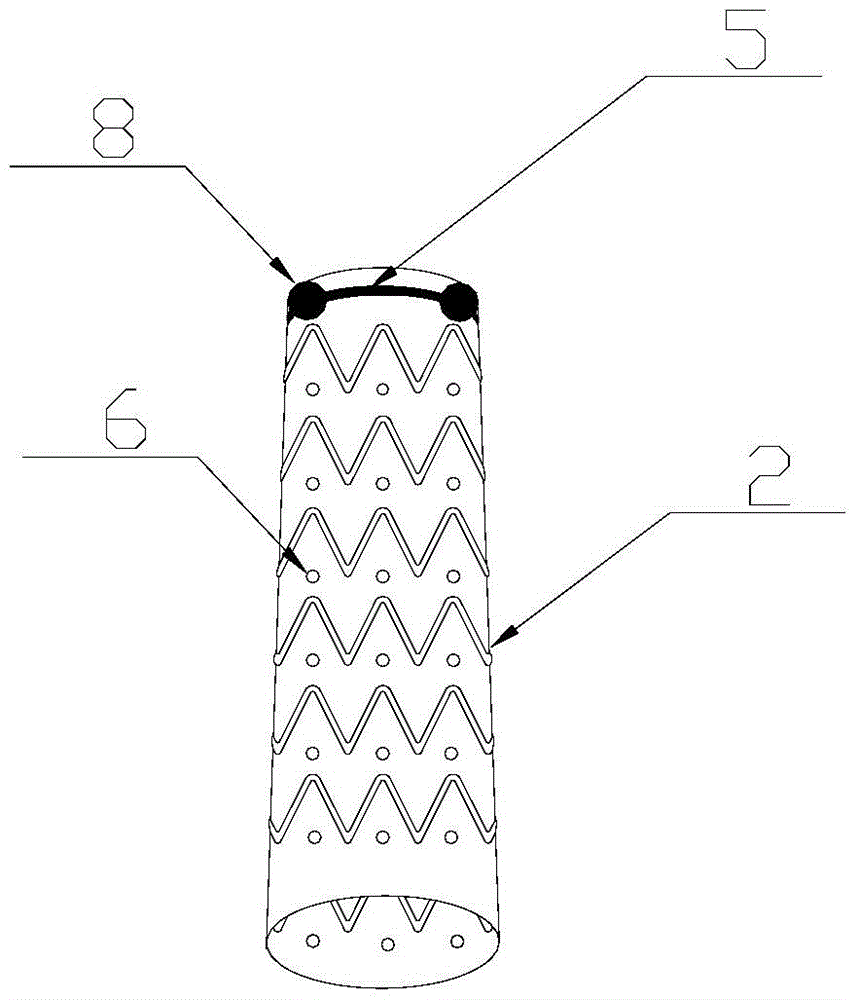 a stent graft