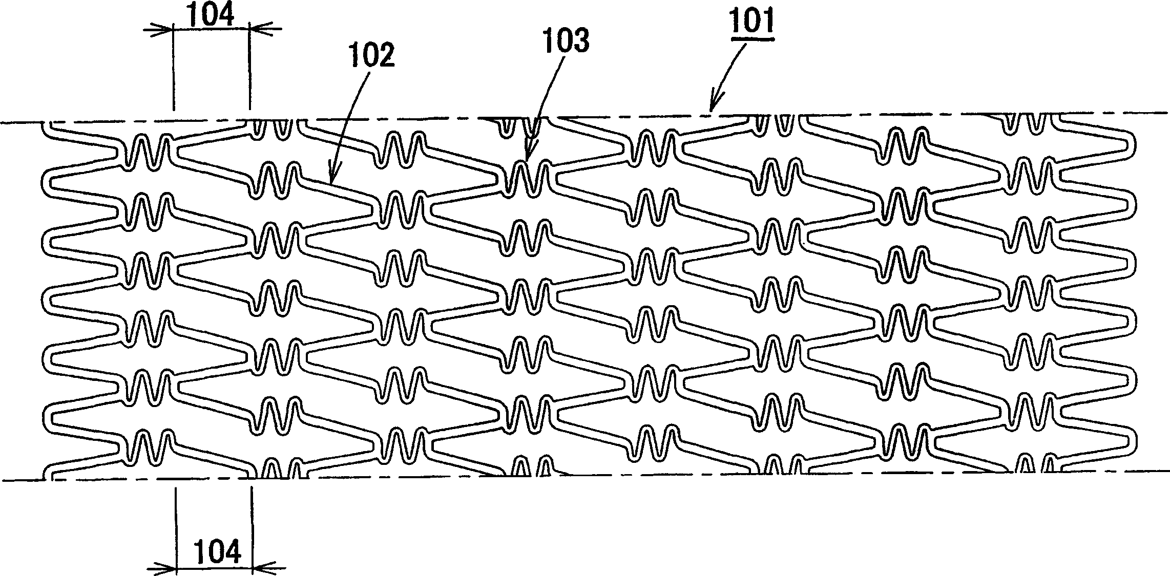 Stent