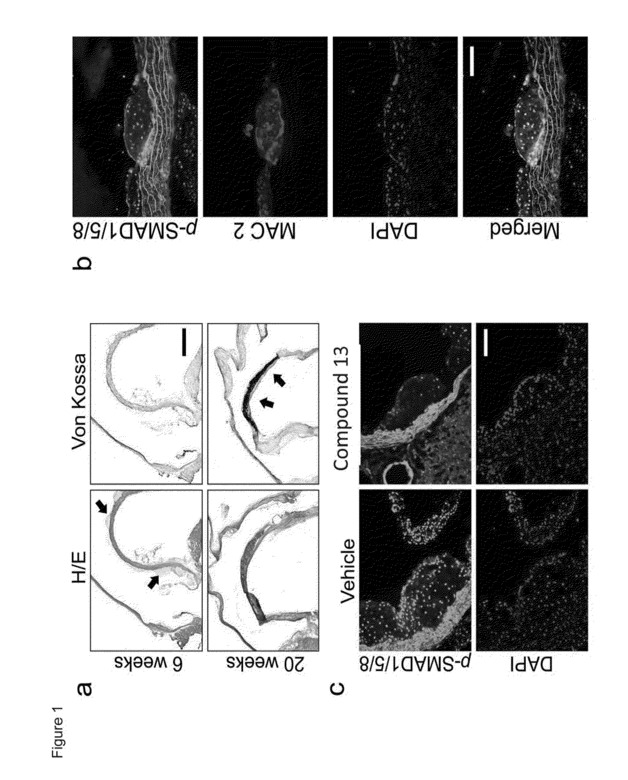 Compositions and methods for cardiovascular disease