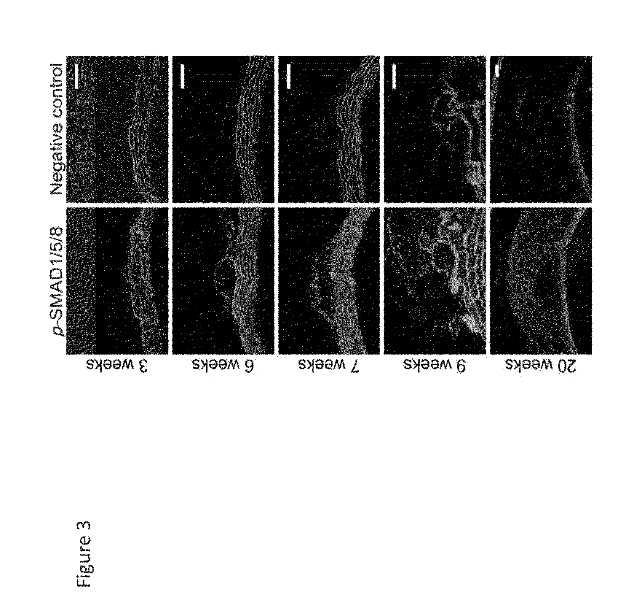 Compositions and methods for cardiovascular disease