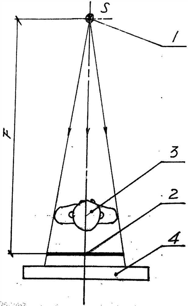 X-ray anti-scattering grating based on orthogonal structure