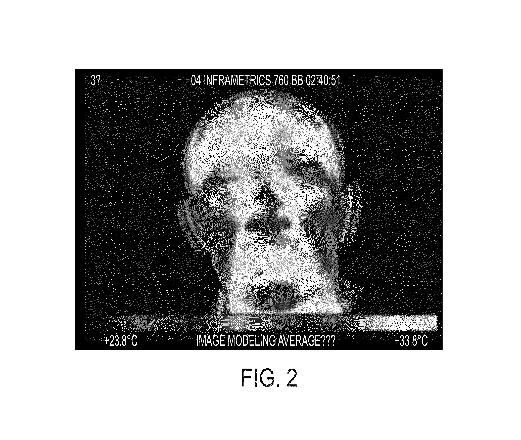 Monitoring respiration with a thermal imaging system