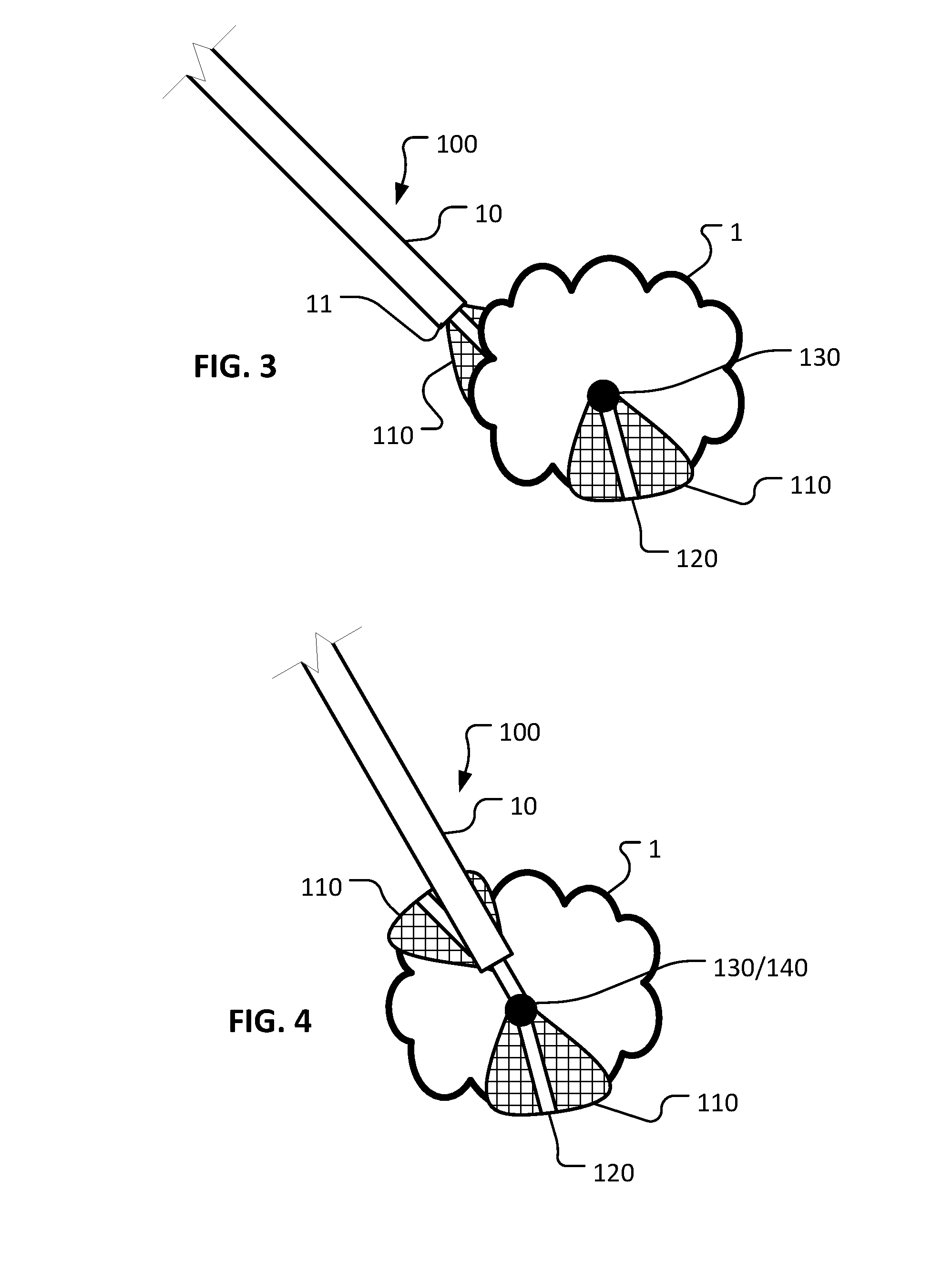 Laparoscopic retractor devices