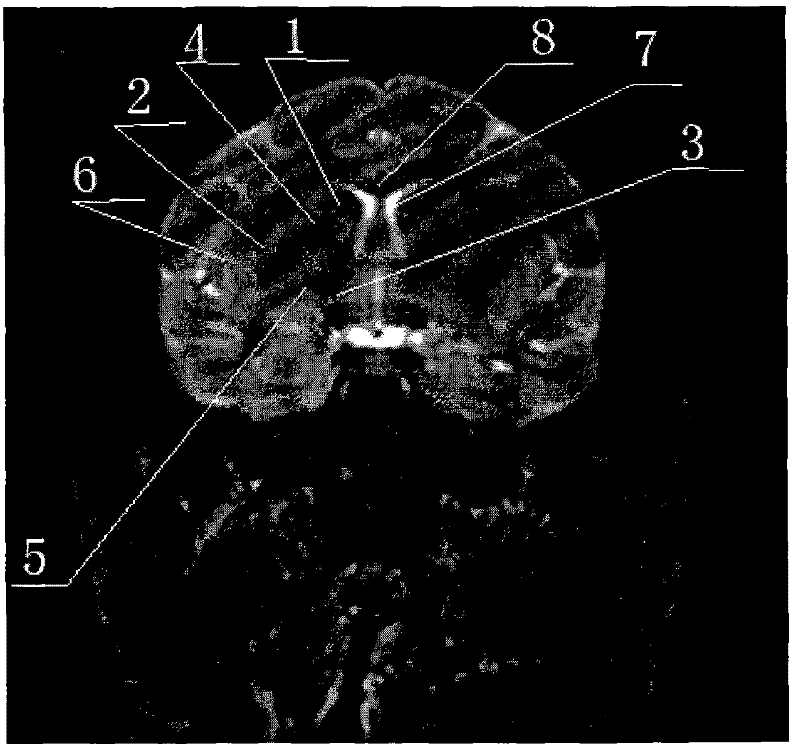 Cynomolgus monkey magnetic resonance scanning method