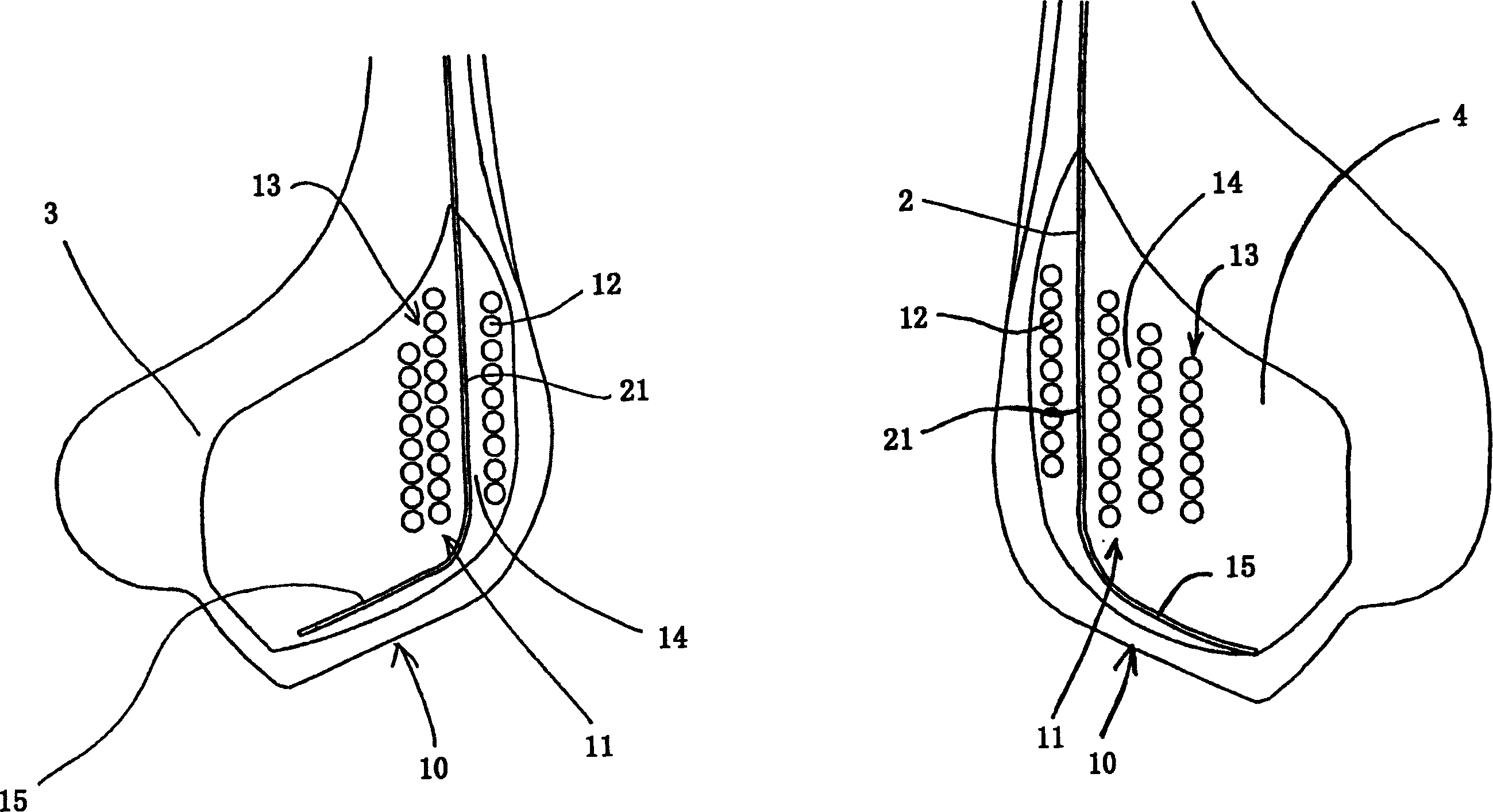 Tyre bead with extended mobility