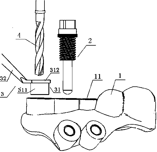 A spiral maxillary sinus lifting device and lifting system