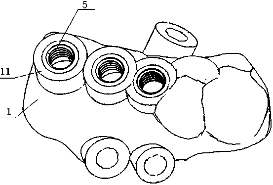 A spiral maxillary sinus lifting device and lifting system