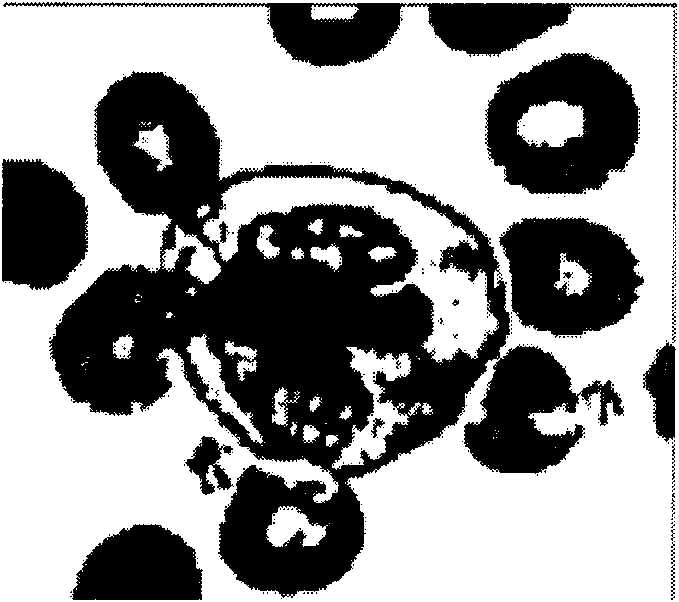 Segmentation method of cell nucleolus and cell membrane based on mixed contour model