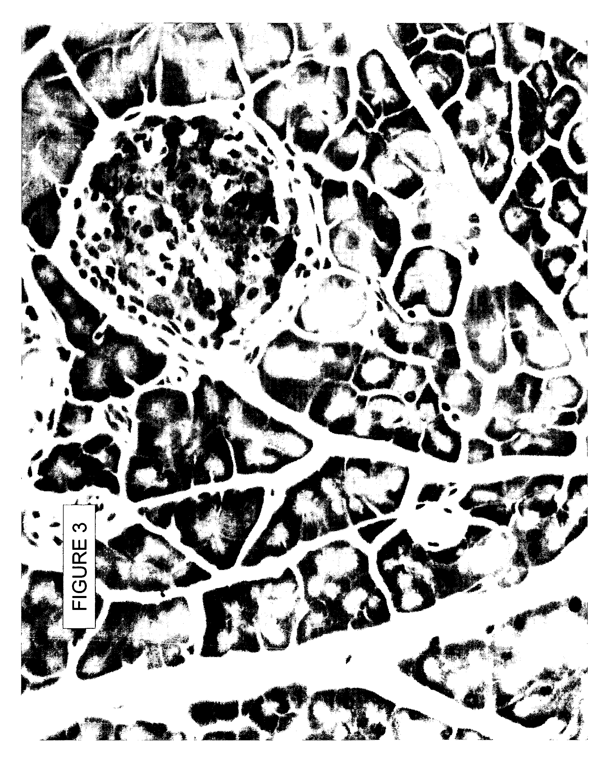 Oral administration of therapeutic agent coupled to transporting agent