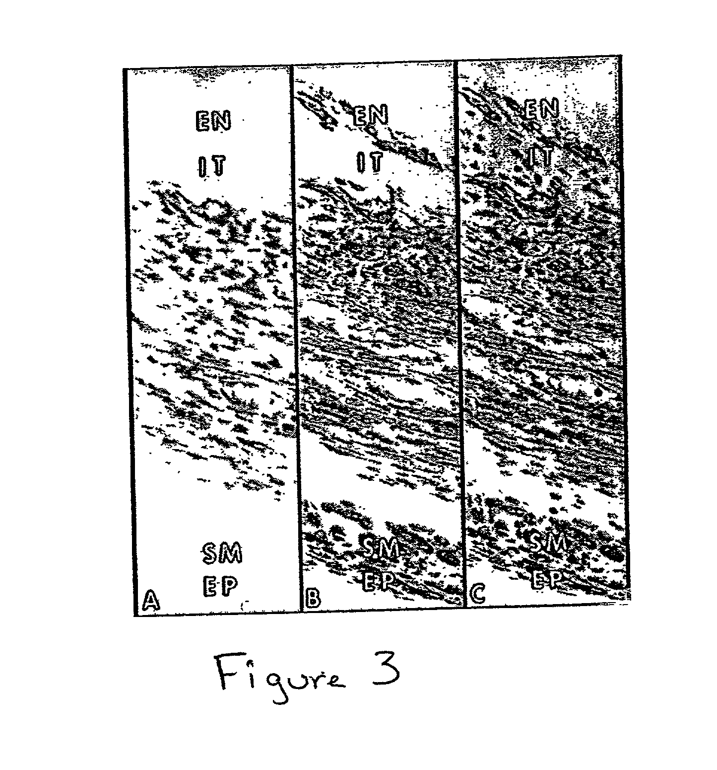 Methods and compositions for the repair and/or regeneration of damaged myocardium