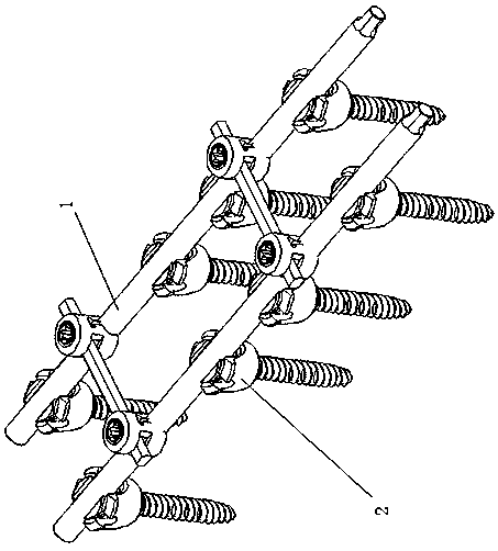 Dynamic screw