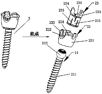 Dynamic screw