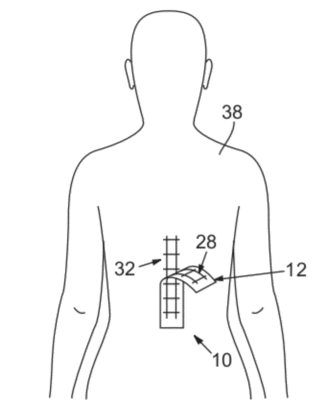 Medical Procedure Localizing Aid