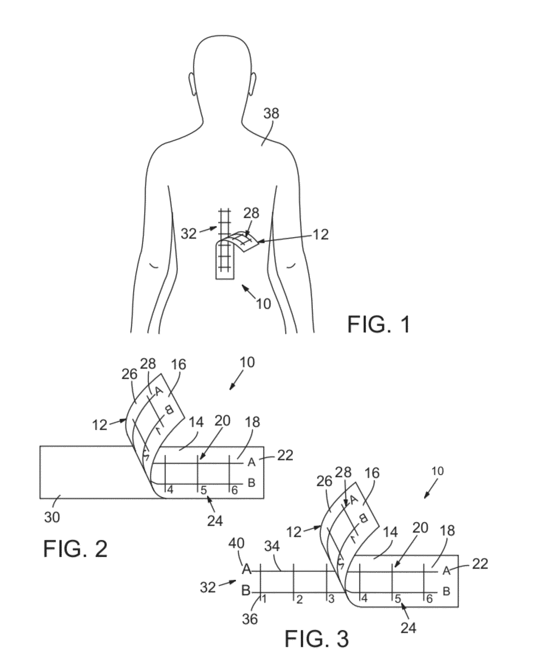 Medical Procedure Localizing Aid