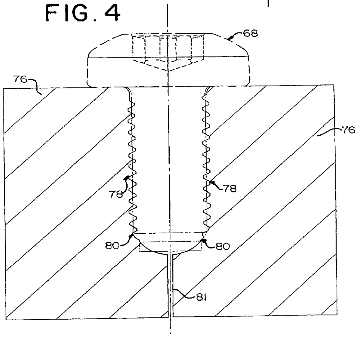 Method of forming a short point anti-cross threading member