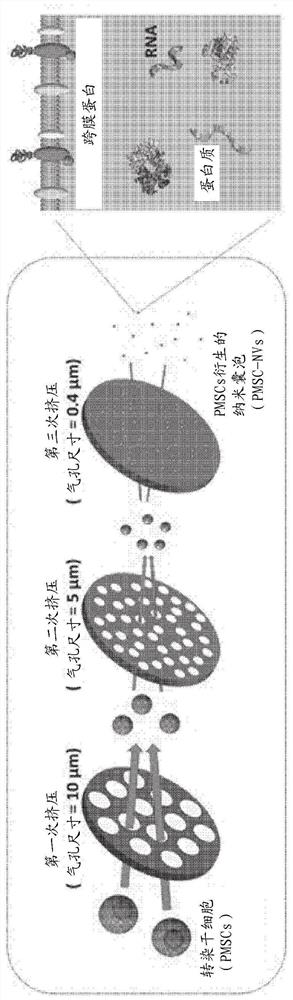 Method for diagnosing and treating arteriosclerosis using blood flow change site-targeted nanovesicles