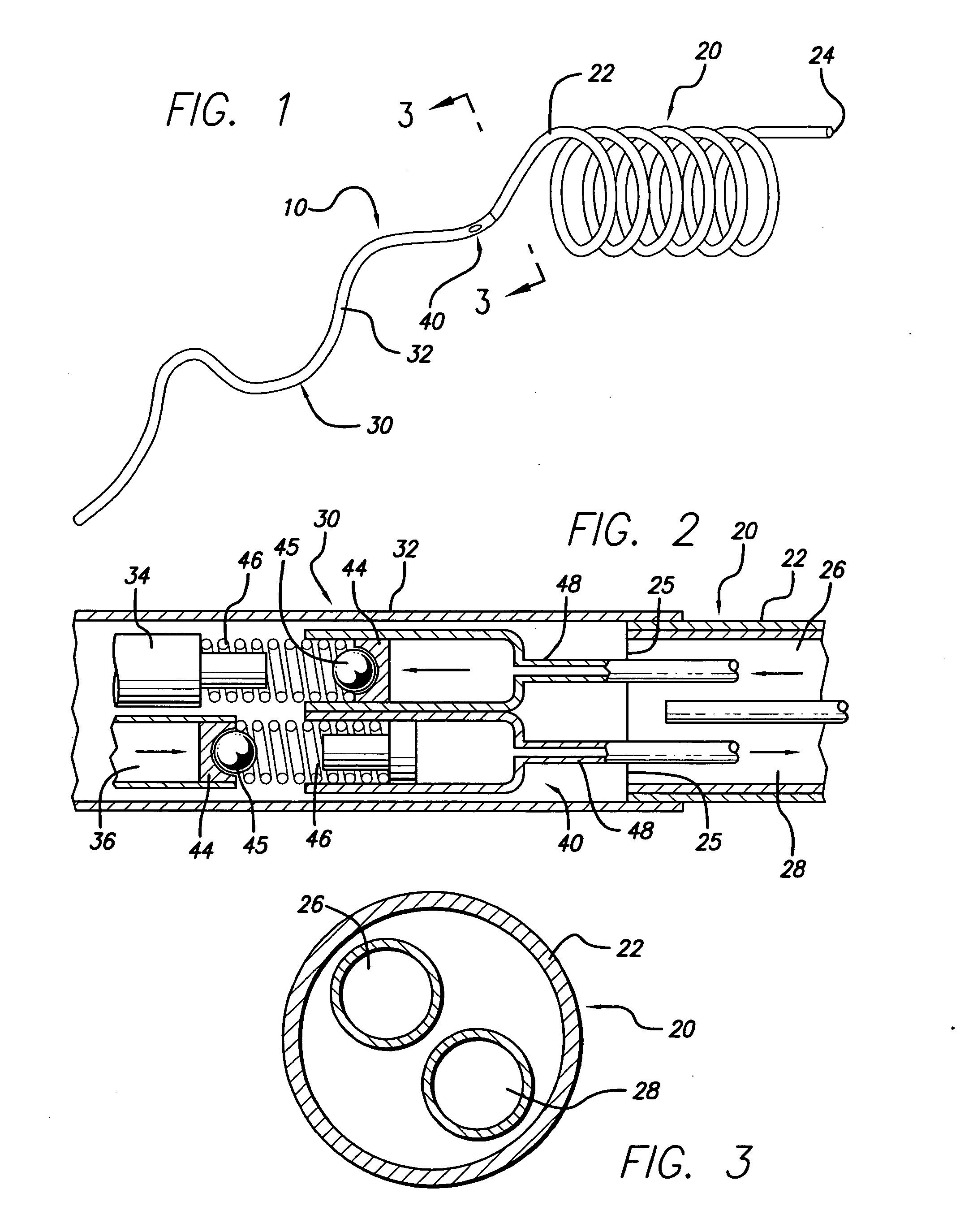 Method of recapturing a stent