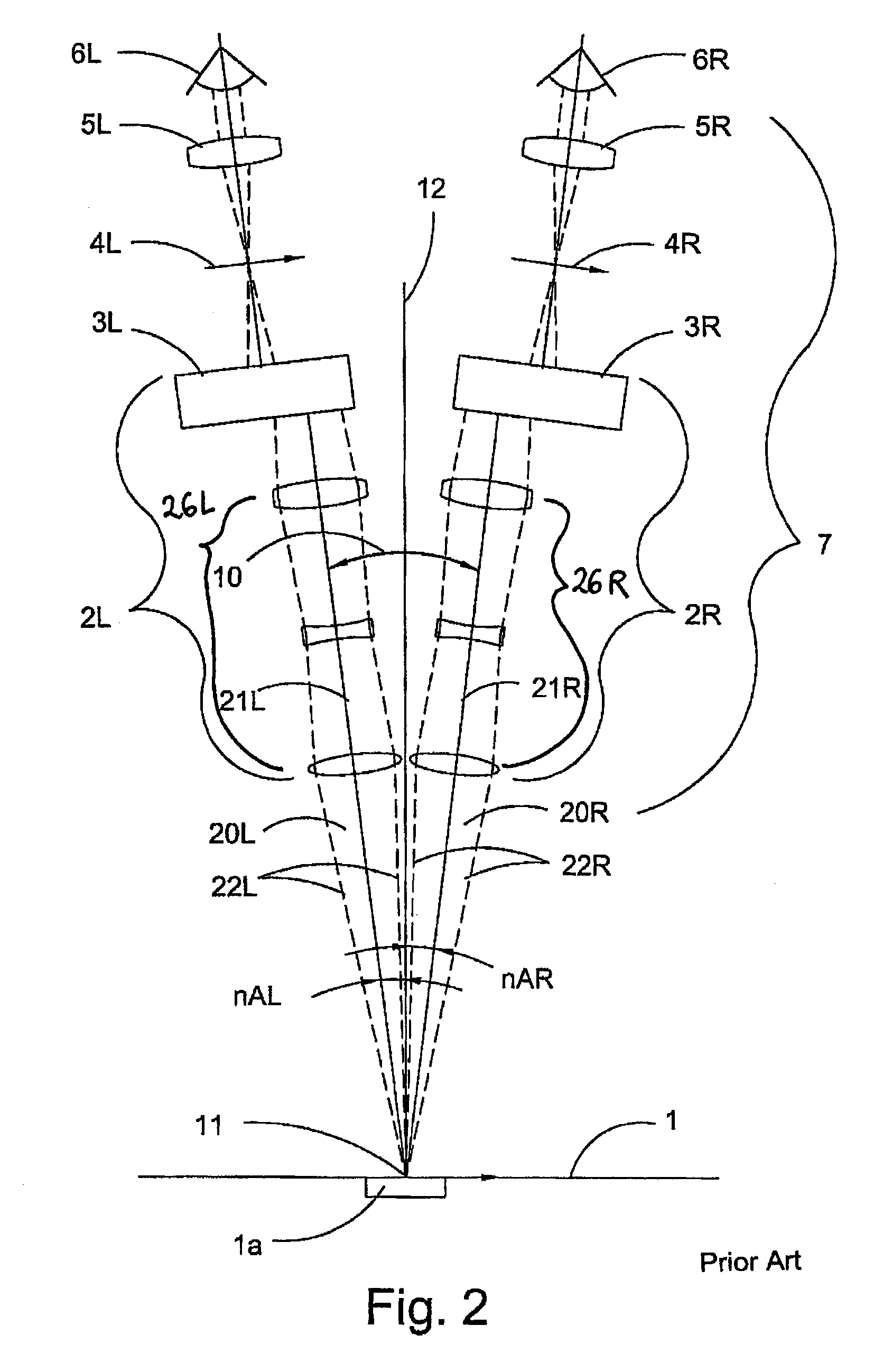 Greenough-type stereomicroscope