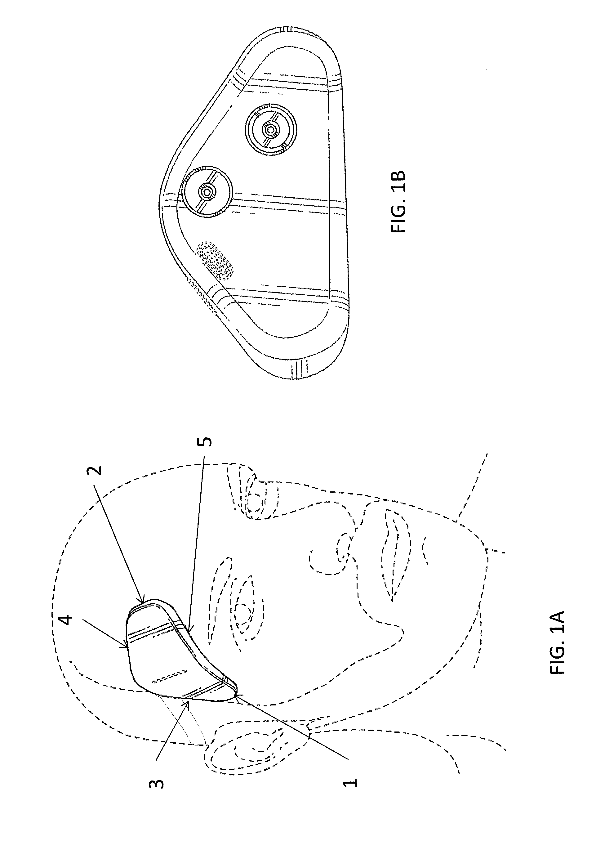 Transdermal neurostimulator adapted to reduce capacitive build-up