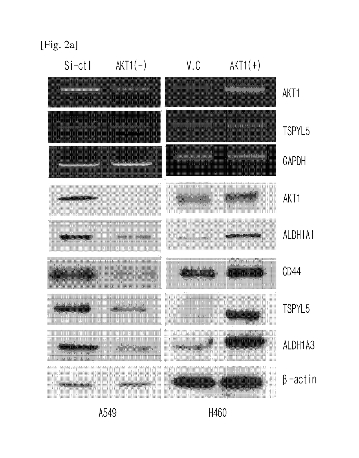 Method for regulating cancer stem cell growth by inhibiting phosphorylation of 120th threonine residue of TSPYL5 protein, a composition containing the peptide sequence functioning to inhibit the phosphorylation and a use thereof