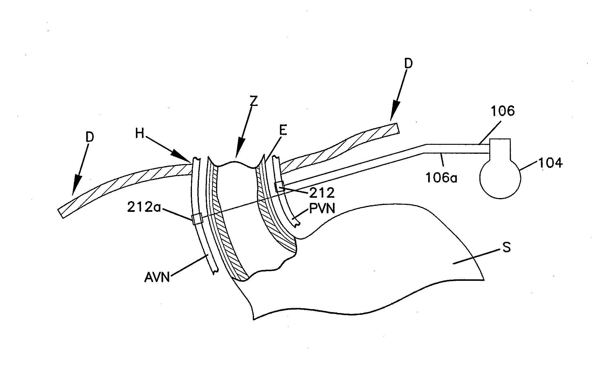 Methods and systems for glucose regulation