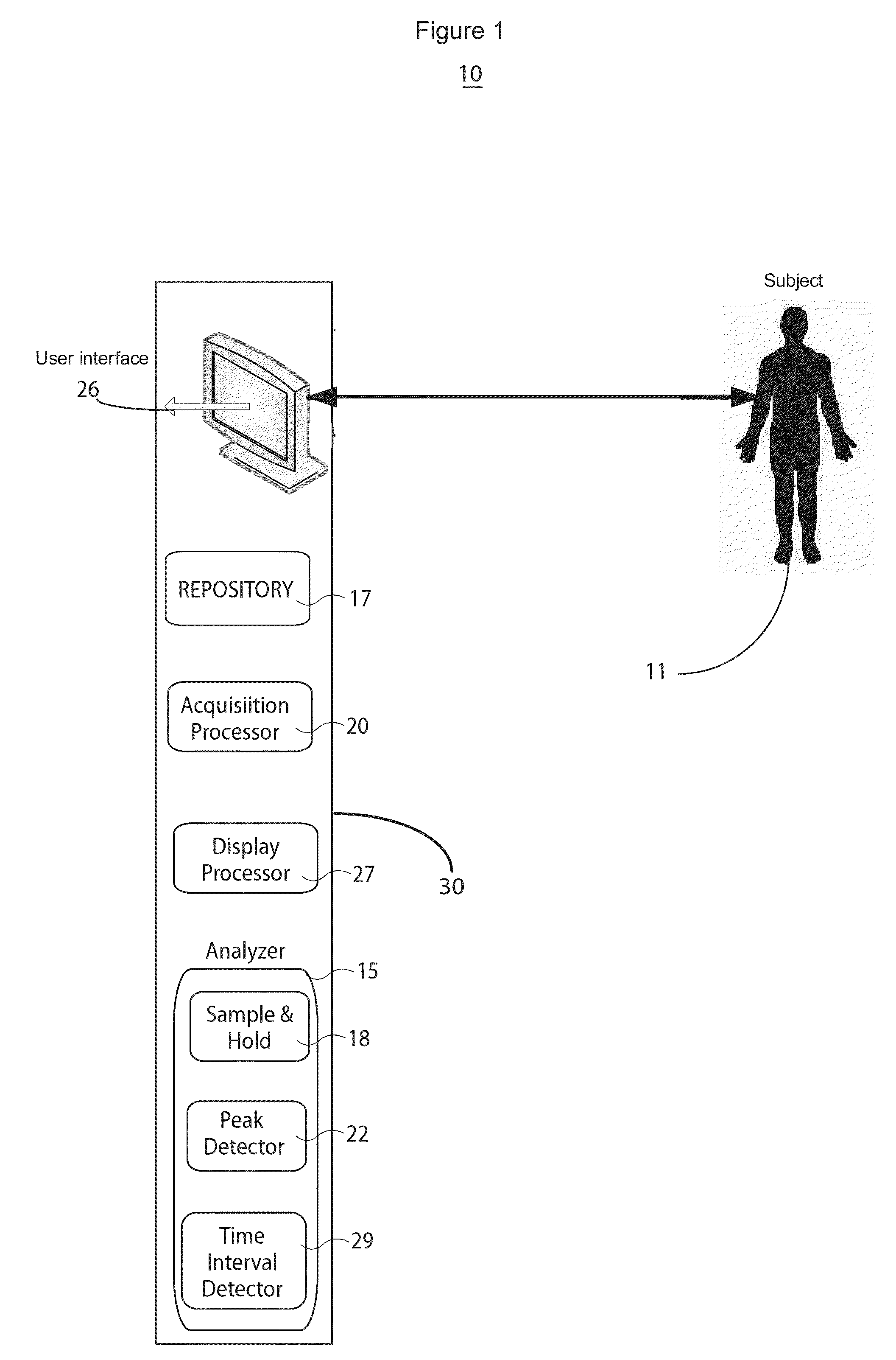 System for monitoring and diagnosis of cardiac electrogram signals using multi-dimensional analysis