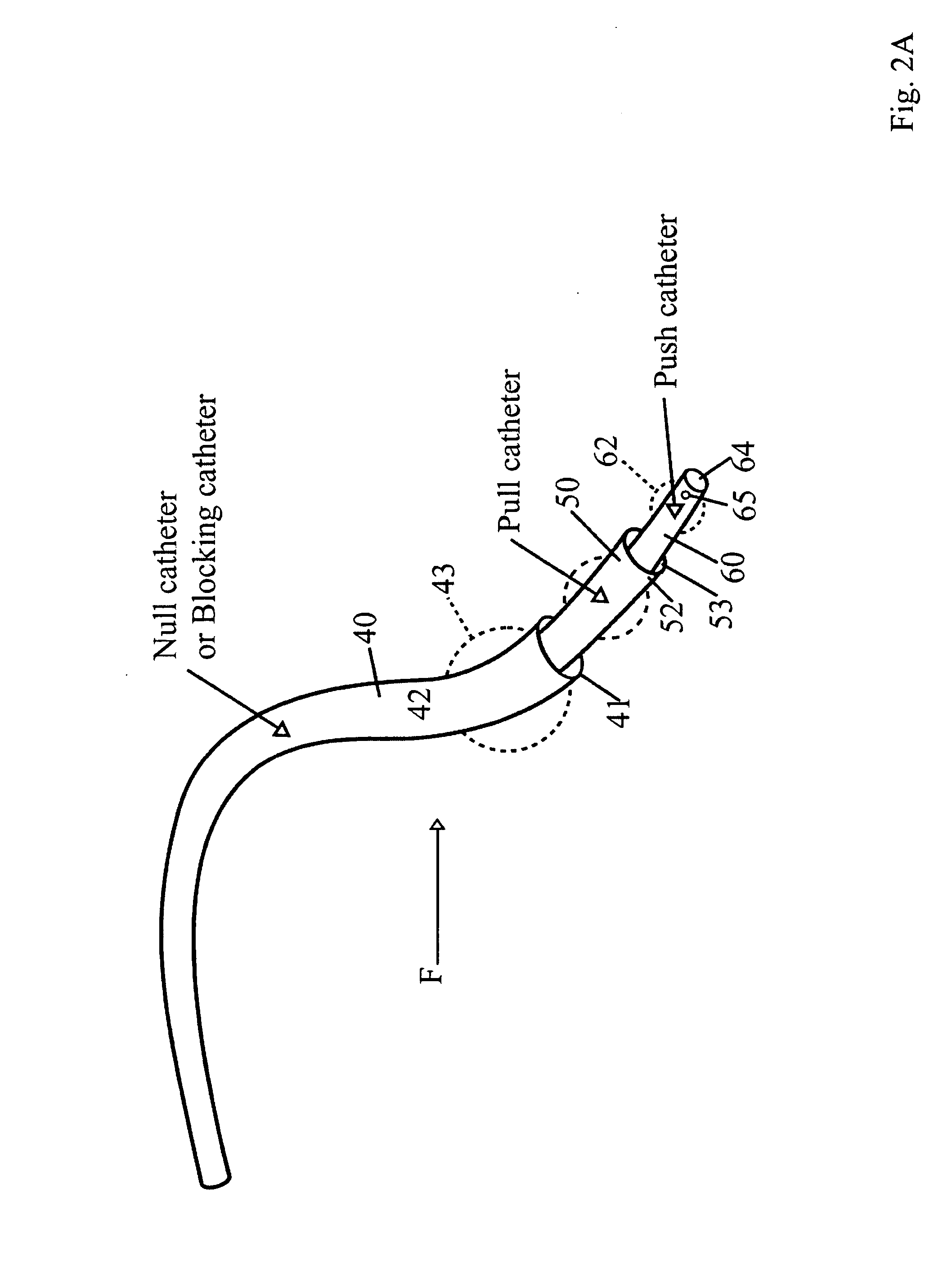 Computerized system for monitored retrograde perfusion of tumor sites