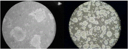 Isolation and culture method of placenta mesenchyma precursor stem cells