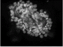 Isolation and culture method of placenta mesenchyma precursor stem cells