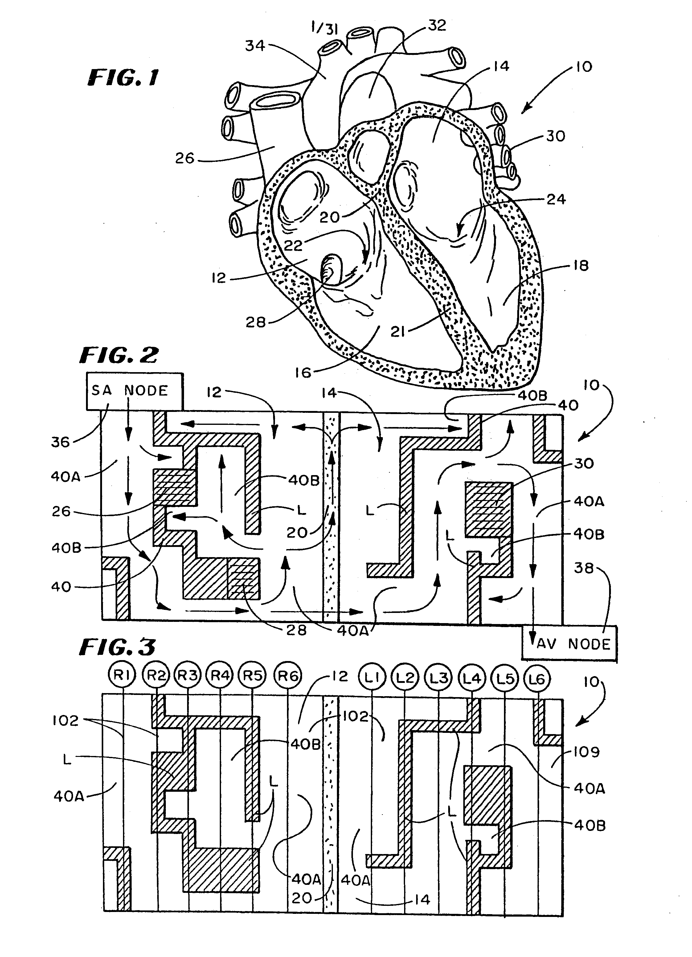 Composite Structures and Methods for Ablating Tissue to Form Complex Lesion Patterns in the Treatment of Cardiac Conditions and the Like