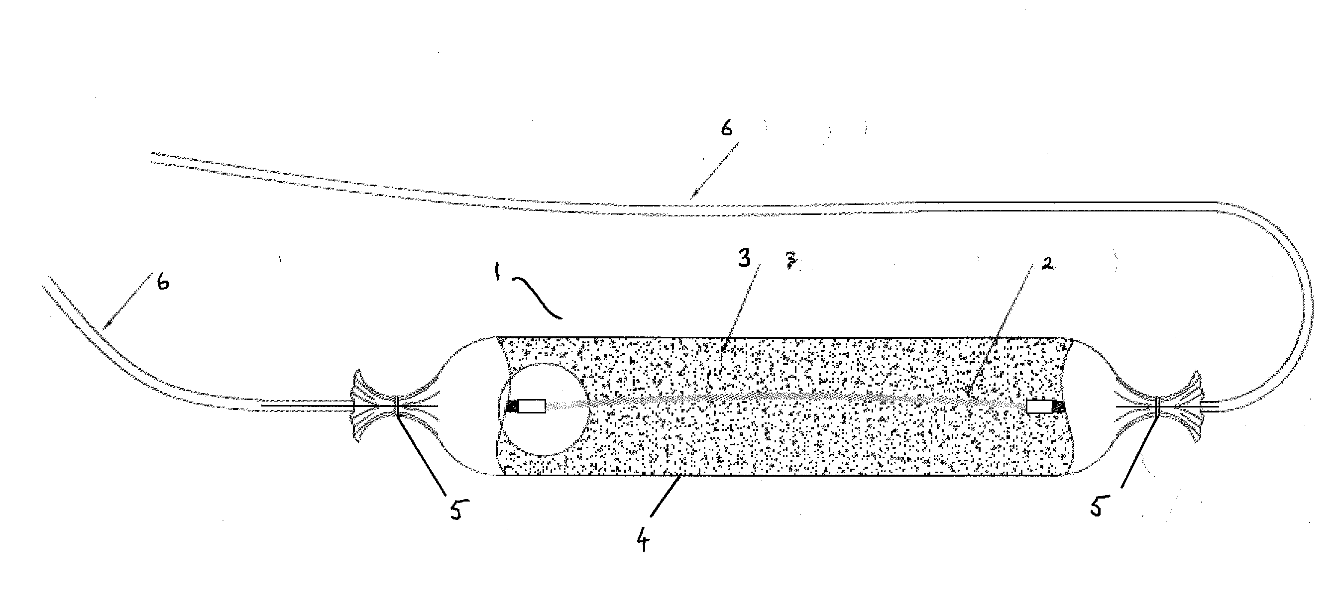 Cathodic protection system