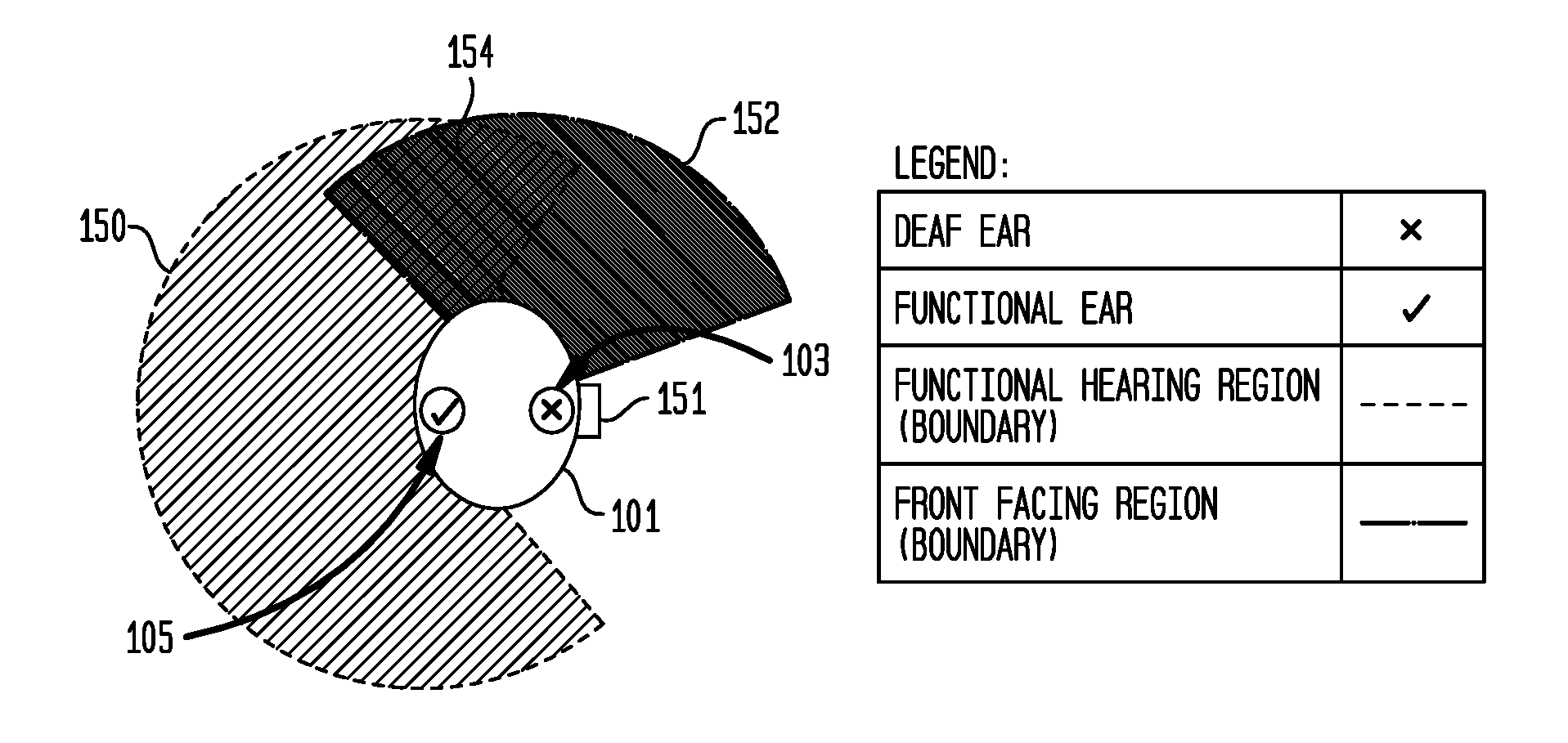 Hearing prostheses for single-sided deafness