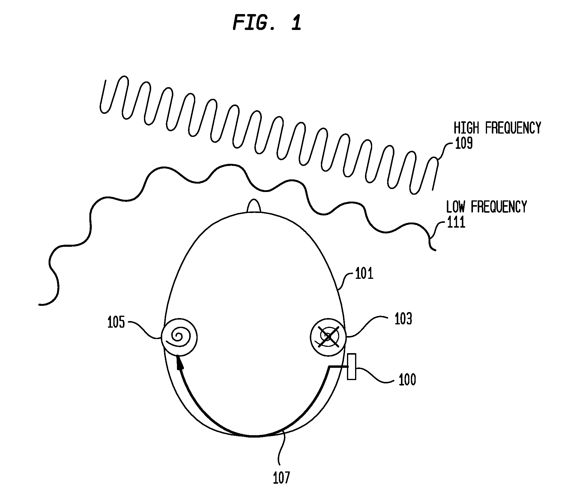 Hearing prostheses for single-sided deafness