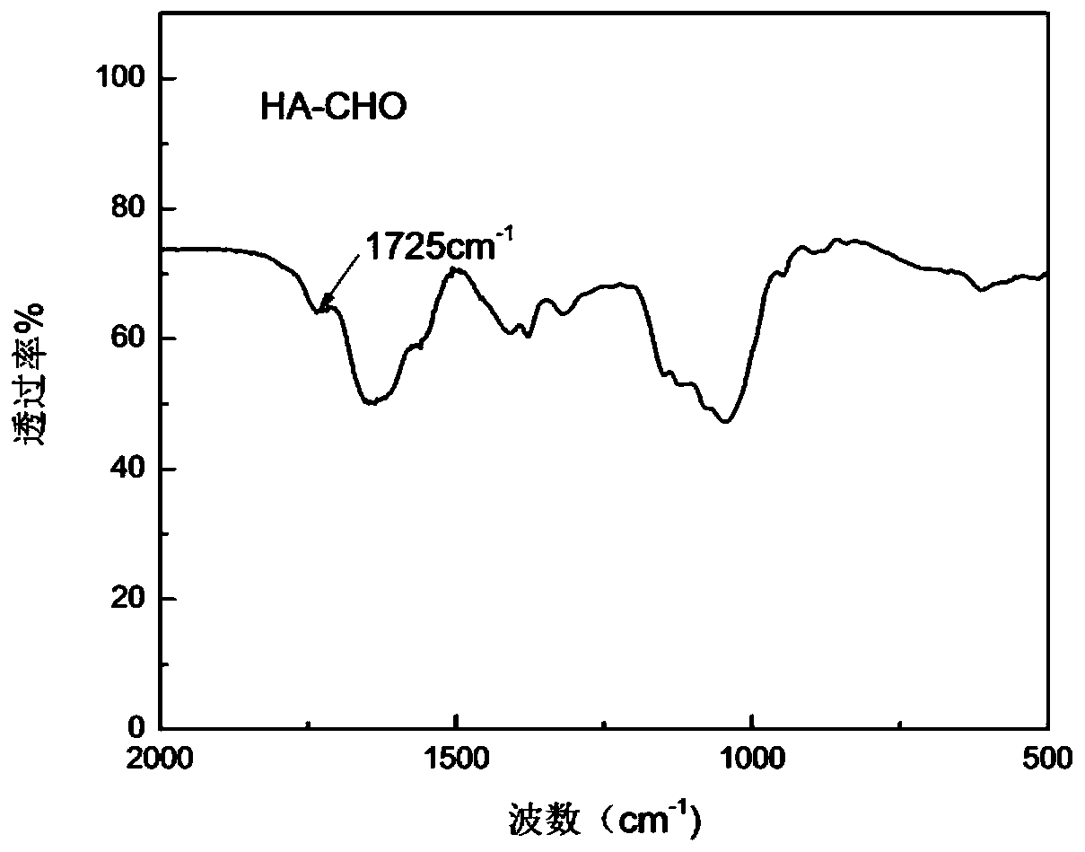 Injectable intelligent response hydrogel and preparation method and application thereof