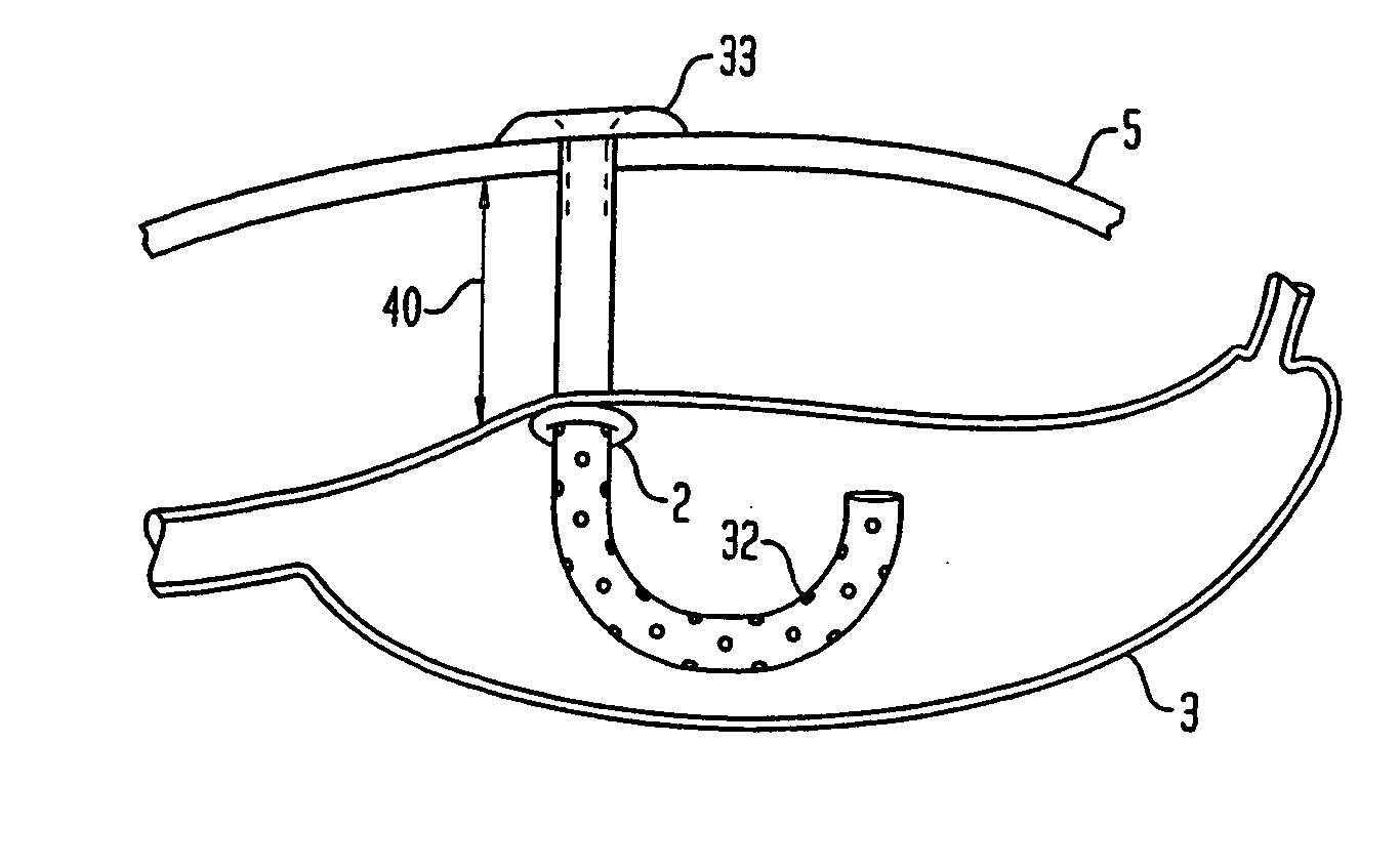 Method for treating obesity by extracting food