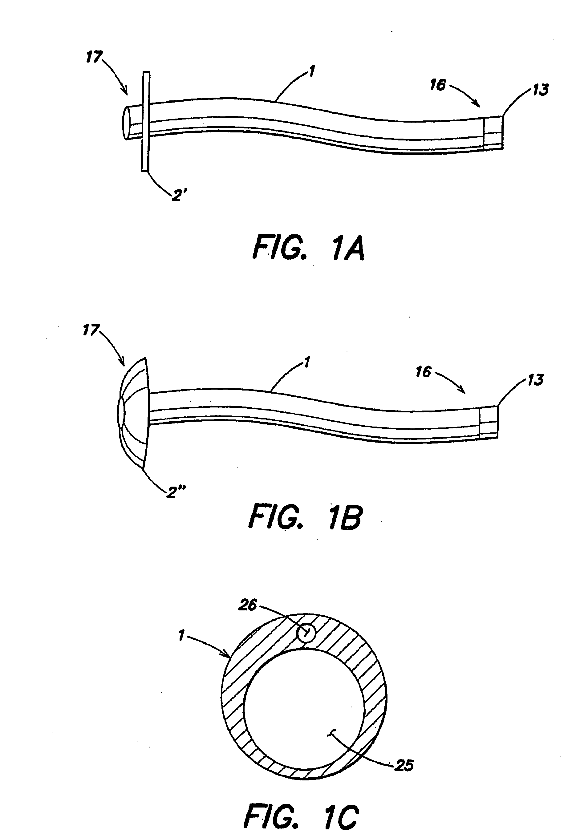 Method for treating obesity by extracting food