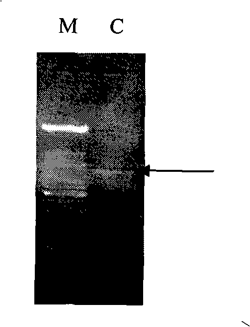 Disease-resistant correlated wheat MYB albumen, coding gene and application thereof