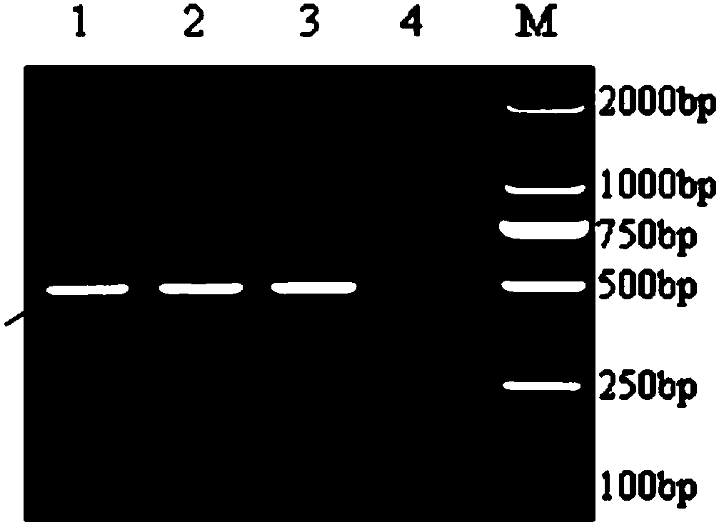 Gene for expressing antibacterial peptide, antibacterial peptide and application