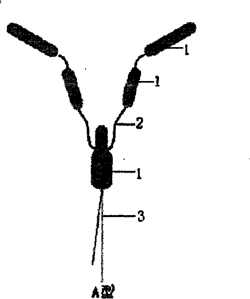 Nano memory alloy intrauterine device