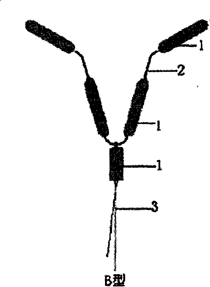 Nano memory alloy intrauterine device