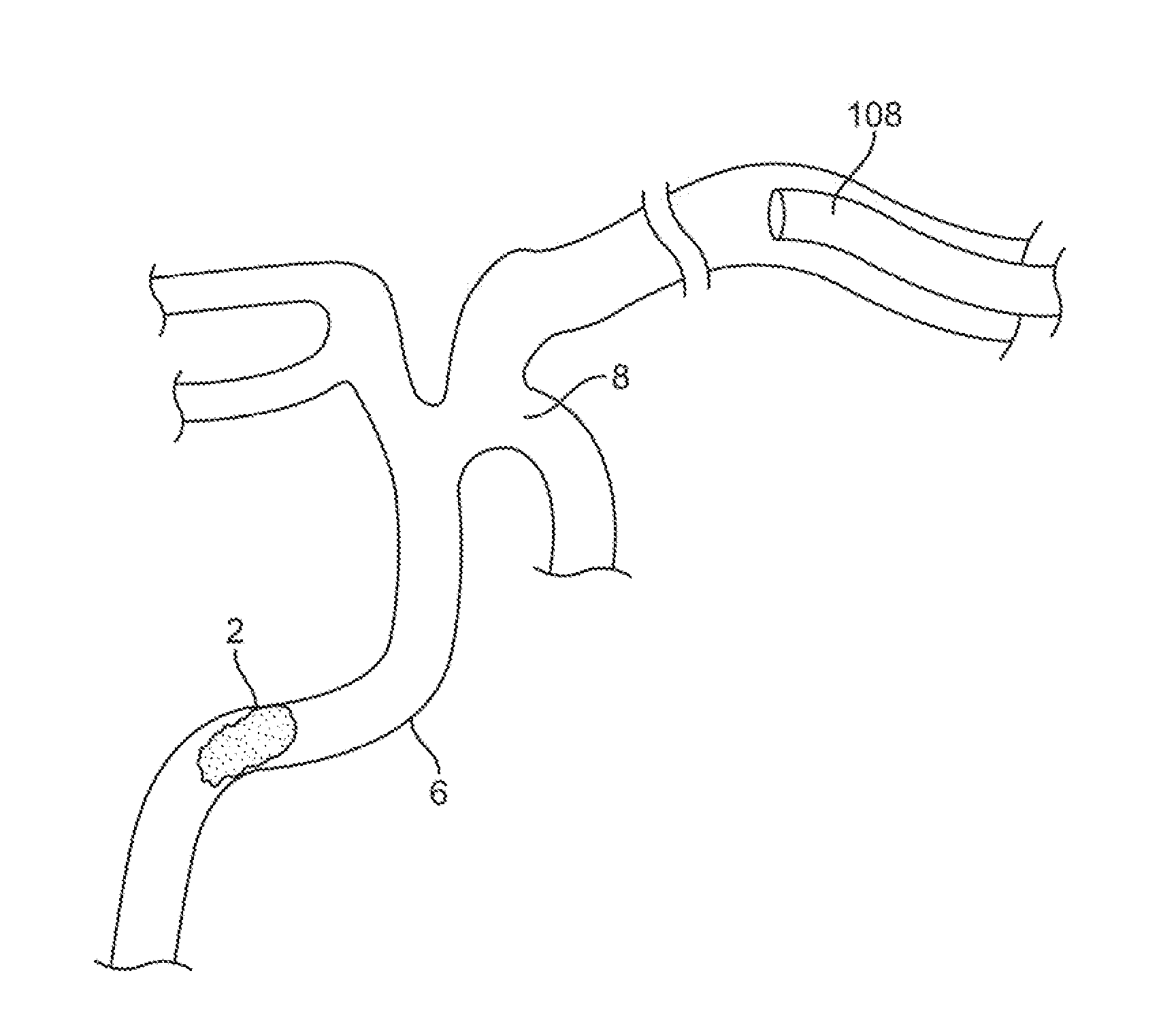 Retrieval systems and methods for use thereof