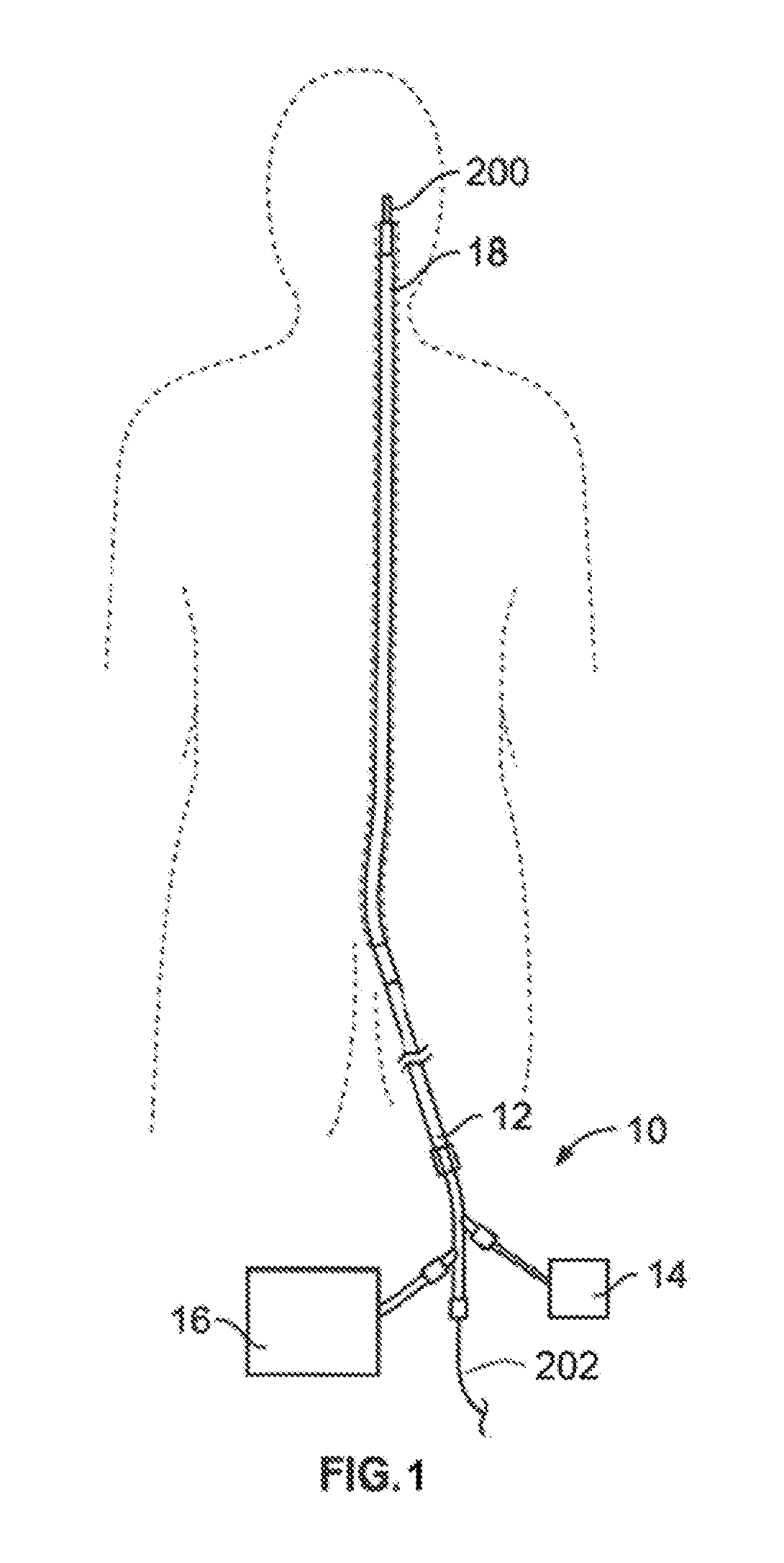 Retrieval systems and methods for use thereof