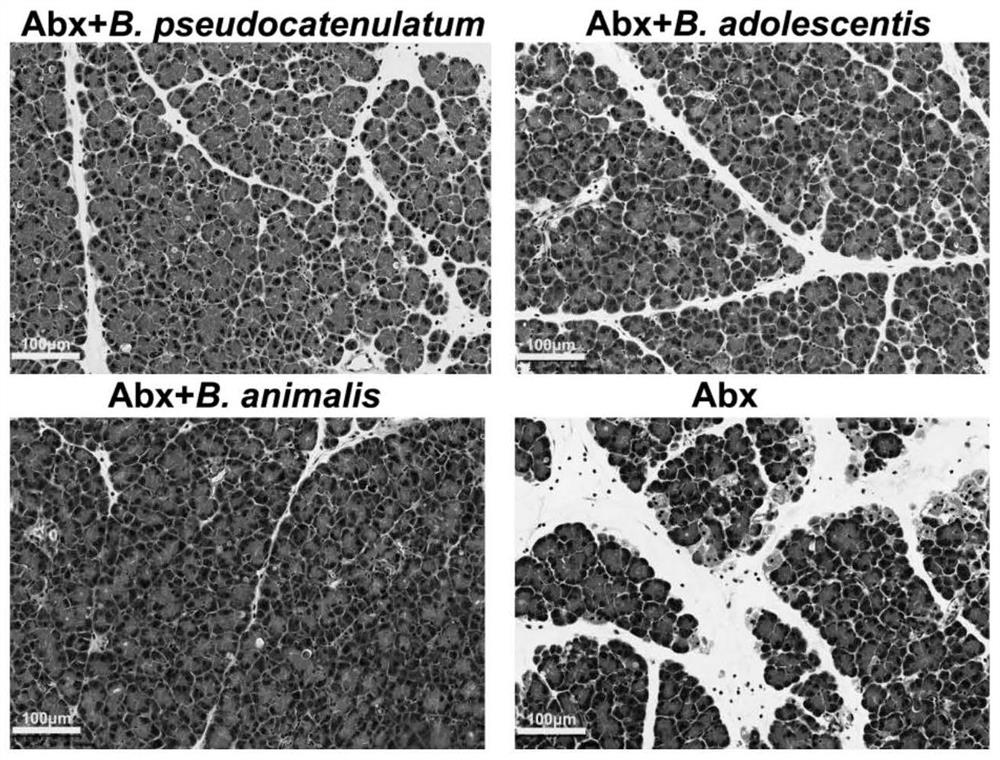 Application of three bifidobacteria to prevention or treatment of acute pancreatitis