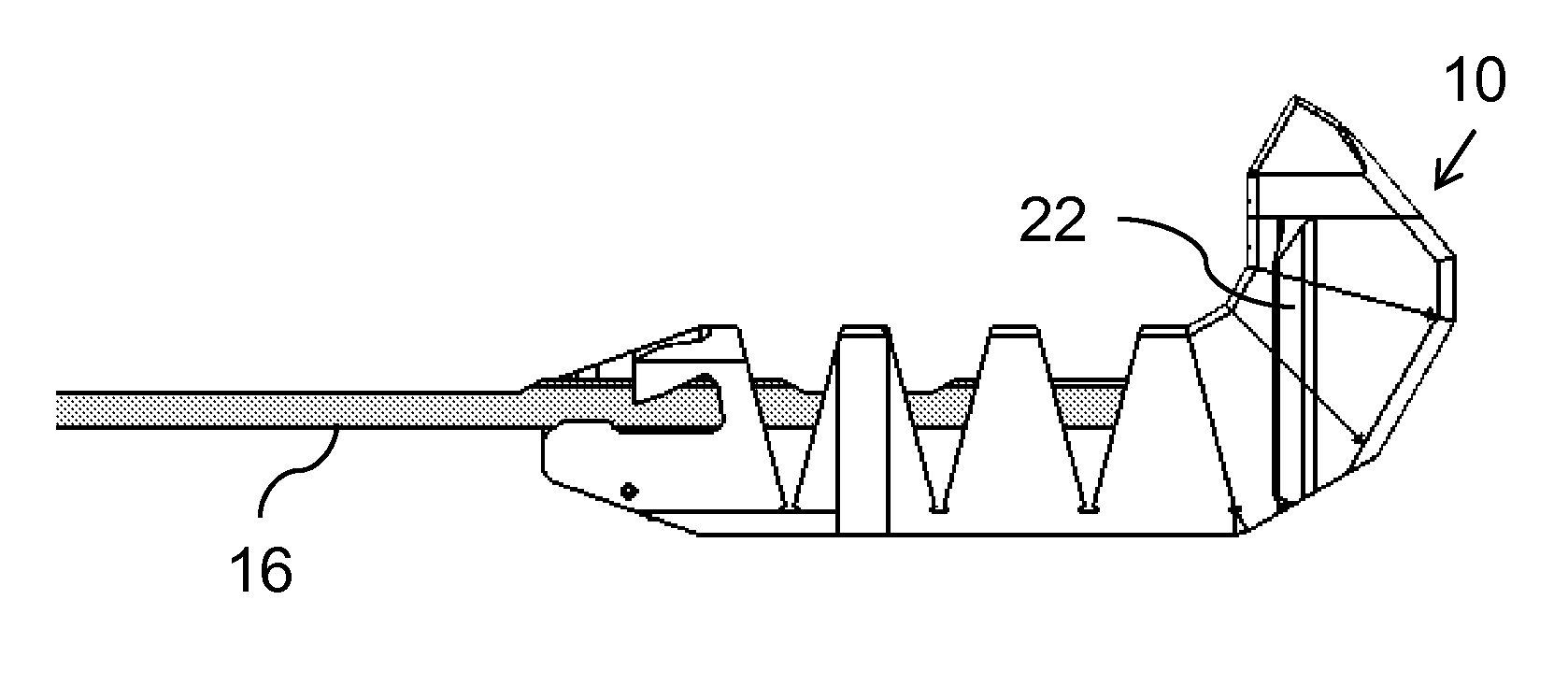 Device and method for spinous process distraction