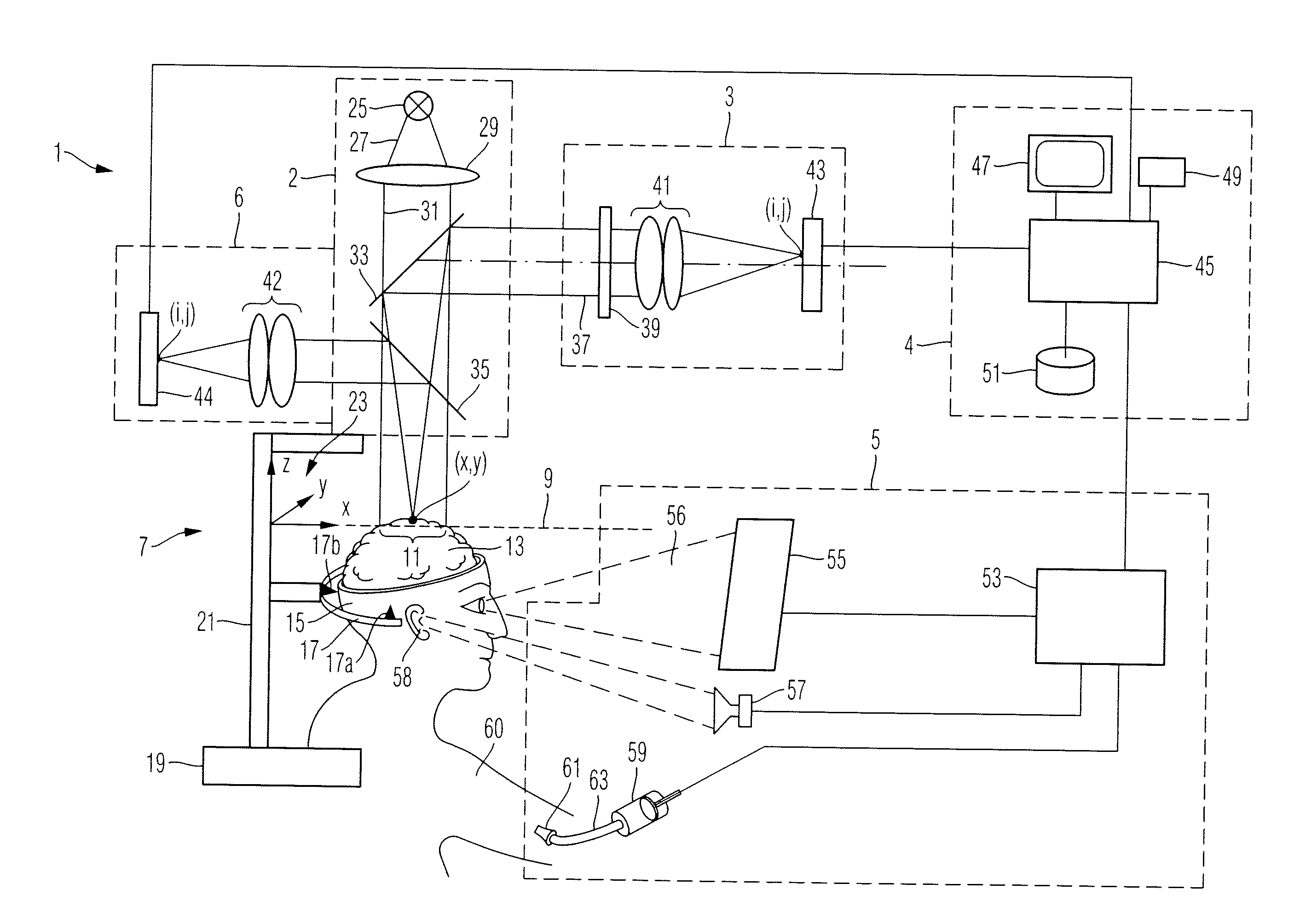 Method and apparatus for displaying a field of a brain of a patient and navigation system for brain surgery