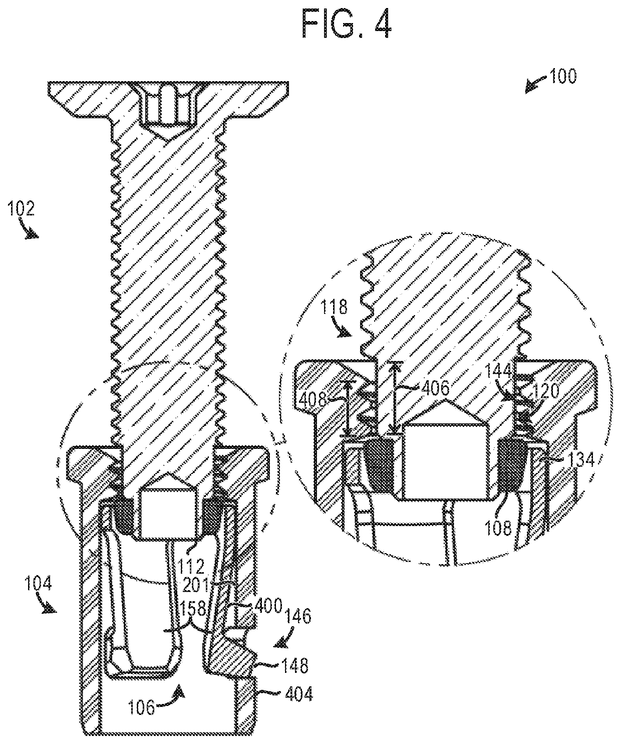 Fastener system