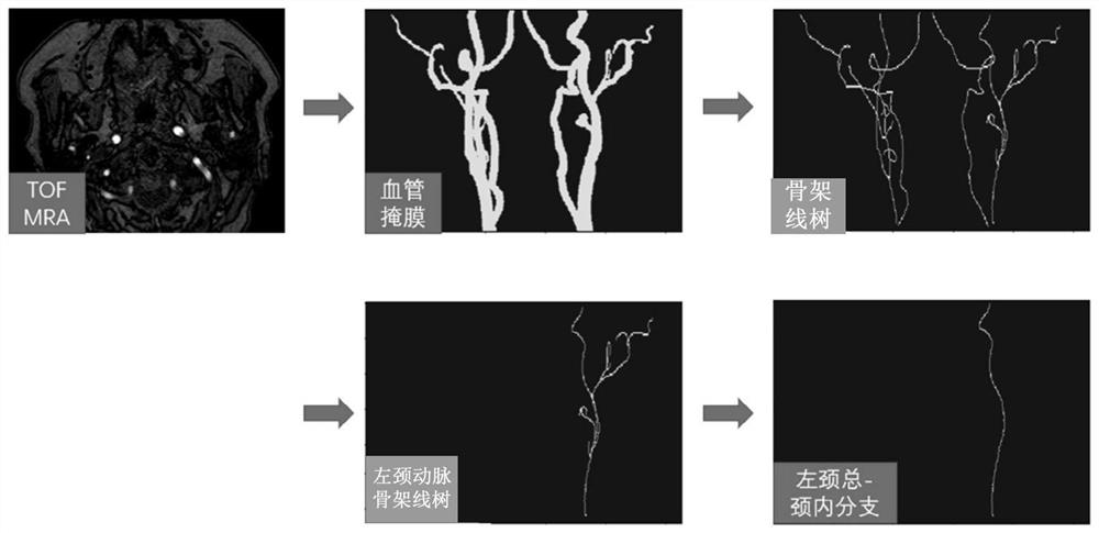 Carotid artery center line extraction method and device, storage medium and electronic equipment